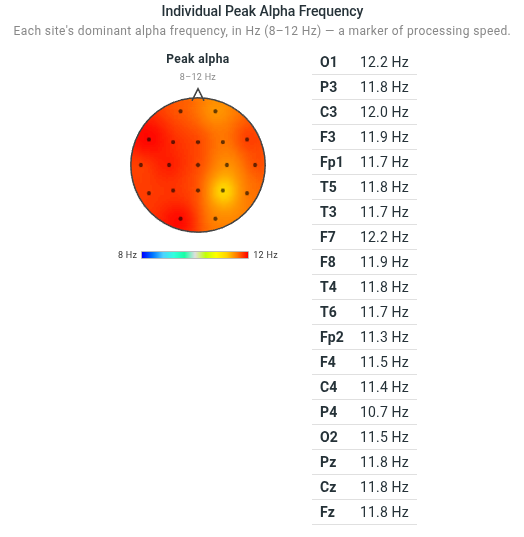 Individual Peak Alpha Frequency Map
